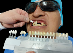 Toma de color dental