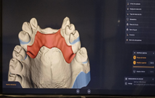 Dise�o digital estructura