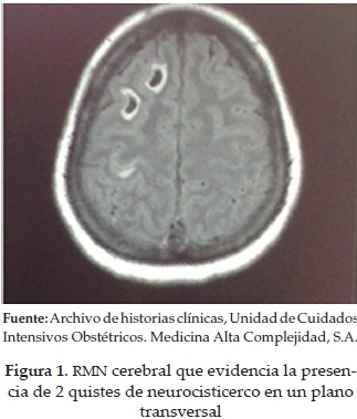 RMN cerebral que evidencia la presenciade 2 quistes de neurocisticerco en un planotransversal