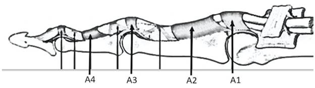 Diagram of the tendon sheath of the fingers and pulley system 