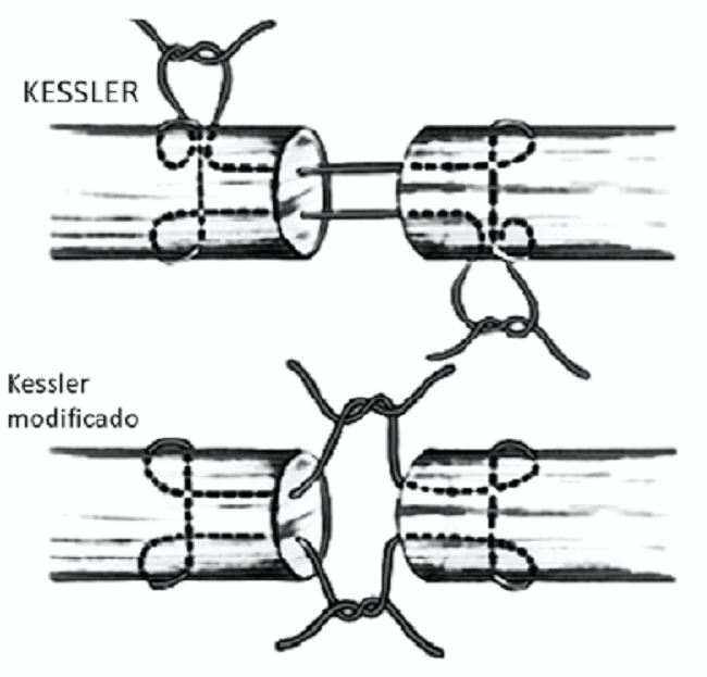 Kessler type knot