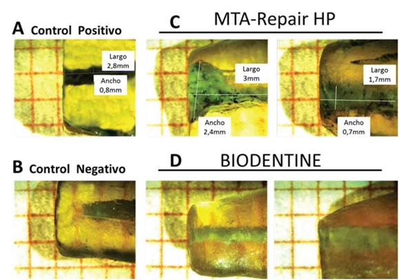 Sample of retrograde fillings with MTA Repair Hp (C) and Biodentine (D)