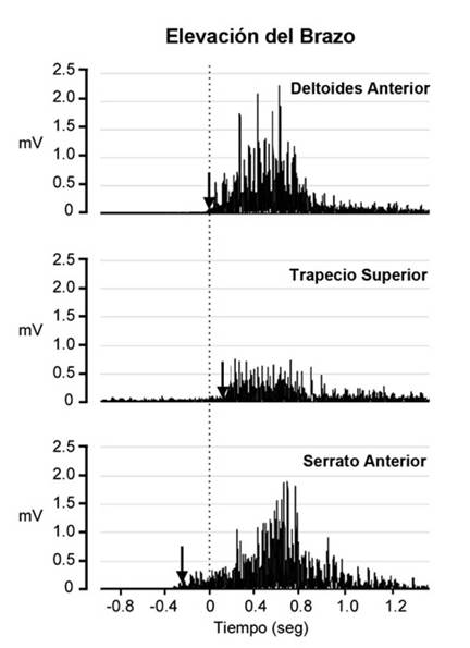 Latencia muscular durante la elevación del brazo. Se representa el patrón normal de activación durante una tarea predecible (ej. Lanzamiento). Se observa que el serrato anterior se activa previo a la activación del deltoides anterior (motor primario) y del trapecio superior con el fin de movilizar la escápula, preparándola para el movimiento del brazo.