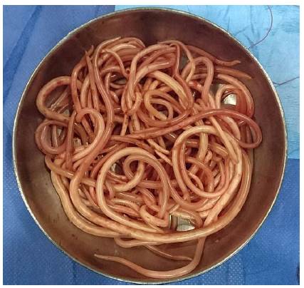 Especímenes extraídos.