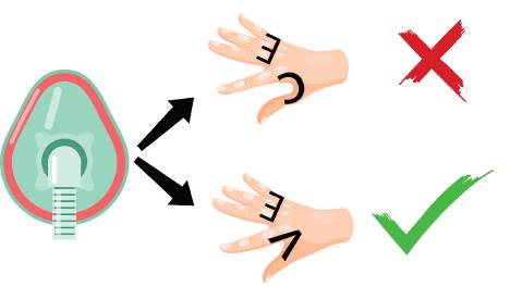 Izquierda: no se recomienda el agarre con una mano "CE". Se recomienda el agarre "ve" a la derecha con 2 manos con eminencias casi tocantes para BVM en el RSI protegido