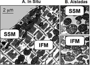 Micrograf&iacute;a electr&oacute;nica de la localizaci&oacute;n y morfolog&iacute;a de mitocondrias SSM e IFM de miocardio de rata. A. Localizaci&oacute;n de las subpoblaciones mitocondriales dentro de las c&eacute;lulas card&iacute;acas. B. Morfolog&iacute;a de las subpoblaciones mitocondriales despu&eacute;s de su aislamiento. Tomada de Holmuhamedov et al. (18)