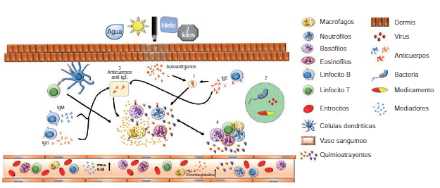 Mecanismos fisiopatológicos propuestos