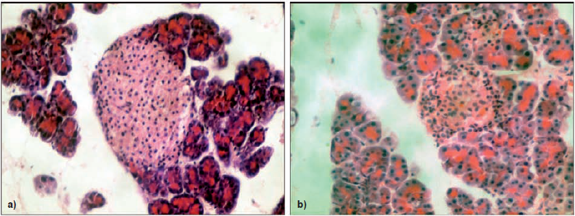 Microfotograf�as de p�ncreas. 