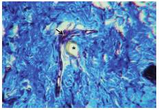 Blood vessel (arrow) collapsed likely due to active sucking up of blood through the maxillary bundle (asterisk). The connective tissue is stained blue. Masson's trichrome stain, 400X