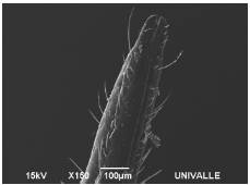 Scanning electron micrograph of the distal end of the labella of the labium of Rhodnius prolixus. The ventral lid is not visualized