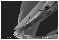 Scanning electron micrograph of the left part of the proboscis of Rhodnius prolixus showing the maxillary inner component (arrow tip). When one of the maxillae (arrow) articulates with its opposite, the salivary canal is formed (*)