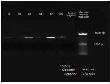 Corrida electrofor&eacute;tica en gel de agarosa al 2 % de los fragmentos amplificados mediante PCR multiplex. Obs&eacute;rvese el amplic&oacute;n de 1.200 pb