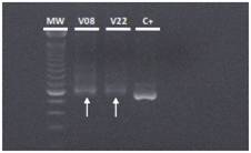 Resultado positivo de la detección de ADN bacteriano mediante PCR en tejidos de las válvulas cardiacas V22 y V8,usando iniciadores ubicuos