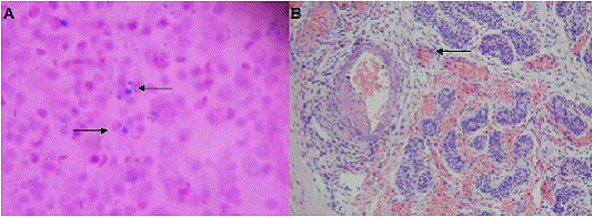 A. Corte de bazo; las flechas muestran el bacilo te&ntilde;ido en color azul. Tinci&oacute;n de Pinkerton, 100X. B. Corte de test&iacute;culo: la flecha muestra el da&ntilde;o vascular. Hematoxilina y eosina, 100X.
