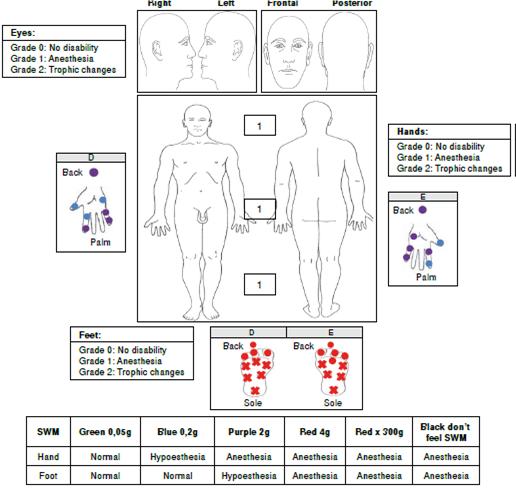 Case 1 findings. SWM: Semmes-Weinsten monofilaments