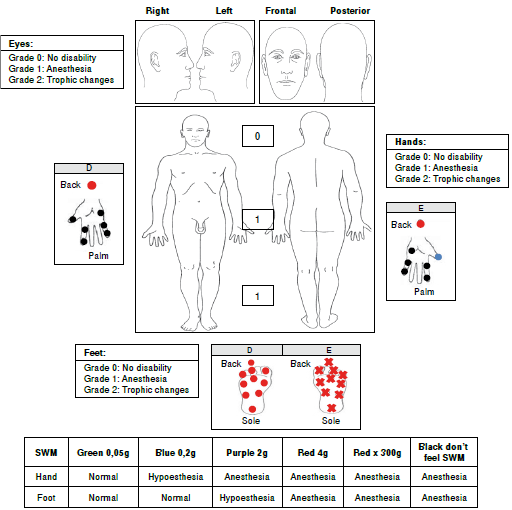 Case 2 findings. SWM: Semmes-Weinsten monofilaments