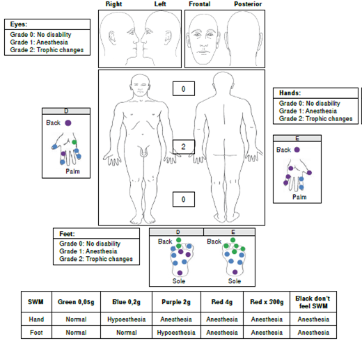 Case 4 findings. SWM: Semmes-Weinsten monofilaments