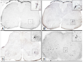 Inmunorreacci&oacute;n del virus de la rabia en cortes transversales de m&eacute;dula lumbar de rat&oacute;n. A: Ant&iacute;genos virales revelados en el asta ventral (L6) a las 24 horas de la inoculaci&oacute;n. B y C: Motoneuronas del n&uacute;cleo Hm9, a nivel de L6 (B) y L5 (C), a las 32 horas de la inoculaci&oacute;n. El contenido de ant&iacute;genos virales es tan alto que permite demarcar la morfolog&iacute;a de las c&eacute;lulas. D: A las 48 horas de la inoculaci&oacute;n, el virus se ha dispersado a neuronas de los dos lados de la sustancia gris (L3) (Im&aacute;genes panor&aacute;micas en 5X y ampliaciones en 40X). N&oacute;tese que los ant&iacute;genos localizados en A est&aacute;n en la misma ubicaci&oacute;n de la neurona inmunoreactiva observada en B.