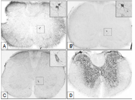 A. Neuronas inmunorreactivas al virus de la rabia localizadas en la l&aacute;mina 8Sp de la m&eacute;dula tor&aacute;cica (T12) a las 40 horas de la inoculaci&oacute;n. B y C. Neuronas inmunopositivas para rabia en la l&aacute;mina 8Sp de la m&eacute;dula cervical C6 (B) y C4 (C) a las 48 horas de la inoculaci&oacute;n. D. Inmunorreacci&oacute;n a la rabia en fase avanzada de la enfermedad (a las 120 horas de la inoculaci&oacute;n) en la m&eacute;dula tor&aacute;cica (T13) (Im&aacute;genes panor&aacute;micas en 5X y ampliaciones en 40X).
