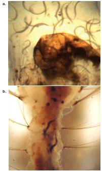 a. Espec&iacute;menes juveniles infectivos al final del ciclo parasitario en una larva de mosquito. b. Espec&iacute;menes juveniles infectivos 'melanizados' en el t&oacute;rax de una larva de mosquito