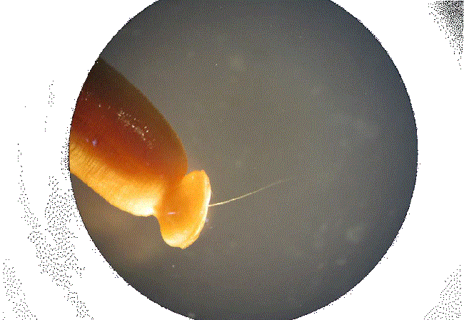 The large bell-shaped copulatrix bursa with a spicule that protrudes and no rays, characteristic of Dioctophyma renale In the literature review we carried out on dioctophymosis in Colombia, we found only one study