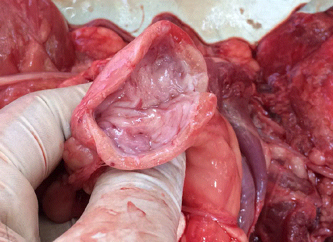 Parenchyma of the right kidney completely destroyed by the parasite after eating the insides of the kidney leaving only the renal capsule of the organ