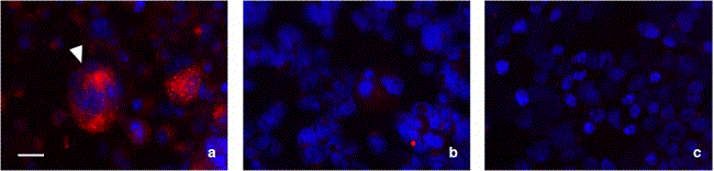 C6/36 cells of Aedes albopictus. Immunofluorescence to detect E protein of flavivirus (MAB8744, Chemicon). a. Cells infected with dengue virus DENV-2, the arrowhead indicates a cell syncytium. b. Negative control of the immunofluorescence assay. c. Mock cells. DAPI was used for nuclei contrast. The localization of the antigen in a, was exclusively cytoplasmic. Bar: 10 μm