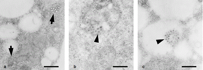 C6/36 cells infected with DENV-2 and fixed in ruthenium red 1%. a. Vesicular-tubular structures located in the cytoplasm (arrows). b and c. Viral particles observed at the cytoplasmic level (arrowheads). Bar: a: 520 nm, b and c: 325 nm
