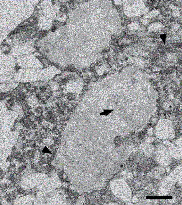 Cellular syncytia in C6/36 mosquito cells observed by Transmission Electron Microscopy. Membrane structures located in the cytoplasm of cells infected with Denv-2 (arrows) and in a nucleus belonging to a cell syncytium (arrowhead). Fixation in tannic acid 4%-glutaraldehyde 2.5%. Bar: 0.6 μm, approximately