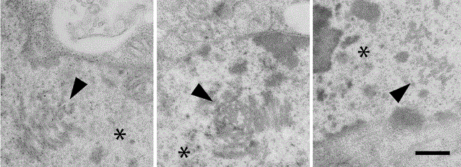 Nuclei of C6/36 cells infected with Denv-2. Membrane structures located in nuclei (arrowheads). The asterisk indicates the nuclear area. Fixation in ruthenium red 1%. Bar: 360 nm