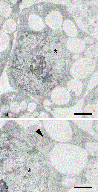 Uninfected C6/36 cells. a. The asterisk indicates the nuclear area. b. Amplification of a., mitochondria (arrowheads). Fixation in ruthenium red 1%. Bar: a: 1.5 μm, b: 0.6 μm approximately