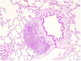 Presencia de BALT en tejido pulmonar porcino, normal en el cerdo pero no en el humano. Coloraci&oacute;n hematoxilina-eosina. 10x