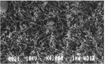 Microscop&iacute;a electr&oacute;nica de barrido donde se observan cilias con un di&aacute;metro de 12 a 14 μm. 4.000 X