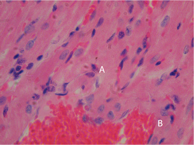 Nido parasitario con amastigotes (A) y congestión de vasos sanguíneos (B) en tejido cardiaco de Rattus rattus naturalmente infectado con Trypanosoma cruzi, capturado en un ambiente suburbano de Mérida, Yucatán, México. Hematoxilina y eosina, 100X
