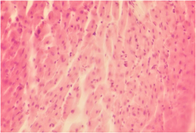 Infiltrado inflamatorio linfocitario multifocal moderado crónico, compuesto por linfocitos e histiocitos en tejido cardiaco de Mus musculus naturalmente infectado con Trypanosoma cruzi, capturado en un ambiente suburbano de Mérida, Yucatán, México. Hematoxilina y eosina, 40X