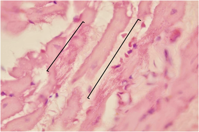 Fibras cardiacas (corchetes) con degeneración celular en tejido cardiaco de Rattus rattus naturalmente infectado con Trypanosoma cruzi, capturado en un ambiente suburbano de Mérida, Yucatán, México. Hematoxilina y eosina, 100X