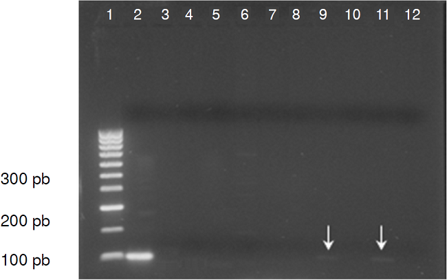 Electroforesis en gel de agarosa al 1,2 % con los resultados de la PCR convencional para la detecci&oacute;n de T. gondii en muestras de donantes de sangre. En el pozo 1: marcador de peso molecular de 100 pb (HyperLadder&trade;); en el pozo 2: control positivo (ADN T. gondii cepa RH); en los pozos 3 a 10: muestras de donantes de sangre (n&oacute;tense en los pozos 9 y 11, productos de amplificaci&oacute;n d&eacute;biles); en el pozo 12: control negativo (agua destilada)