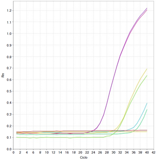 Gr&aacute;fica de amplificaci&oacute;n de la regi&oacute;n repetitiva RE de T. gondii por PCR en tiempo real. Control positivo (ADN de la cepa RH de T. gondii). Control threshold (CT), 24,89 (color morado); donante de sangre del Hospital Universitario Erasmo Meoz seropositivo con parasitemia detectada por PCR convencional (pozo 9): CT 30,87 (colores verde y naranja); donante de sangre del Hospital Universitario Erasmo Meoz seropositivo con parasitemia detectada mediante PCR convencional (pozo 11): CT 36,63 (color azul).