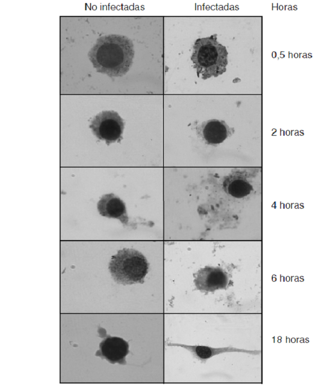 Infecci&oacute;n de la l&iacute;nea celular IC-21 por Salmonella Typhimurium. Los macr&oacute;fagos fueron infectados con S. Typhimurium con una multiplicidad de infecci&oacute;n de 1:50. En la primera columna se observan macr&oacute;fagos no infectados y, en la siguiente, se aprecian las c&eacute;lulas infectadas a las 0,5, 2, 4, 6 y 18 horas. Las c&eacute;lulas fueron te&ntilde;idas con tinci&oacute;n de Wright y observadas en el microscopio &oacute;ptico con un objetivo de 100X. Las flechas negras se&ntilde;alan los bacilos observados en cada una de las micrograf&iacute;as. Los resultados son representativos de tres experimentos independientes