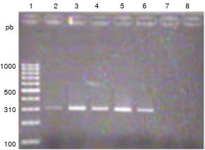 Electroforesis en gel de agarosa al 1,5 % con los amplicones de 310 pb del gen mecA. 1: marcador de talla molecular 100 pb; 2: control positivo con S. aureus ATCC 43300; 3-6: ADN de cepas clínicas de S. aureus; 7: control negativo con S. aureus ATCC 25923; 8: control de reactivos 
