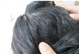 Inspecci&oacute;n de la cabeza en b&uacute;squeda de liendres, ninfas y piojos -peque&ntilde;as formas ovaladas blancas o amarillentas.