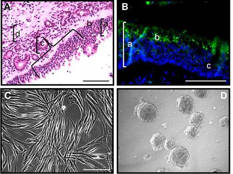 Biopsy specimens from human olfactory mucosa provided sections for histology studies and explants which generated stromal cells and mesenchymal neural spheres under specific culture conditions. A) Tissue section (5 µm) stained with H&E protocol showed a typical architecture of olfactory epithelium from sensory mucosa: a) epithelium; b) basal lamina; c) Bowman ducts; d) olfactory parenchyma. B) Neuronal (3-III tubulin (TUJ-1, green) immunofluorescence counterstained with DAPI (blue) demonstrated that biopsies tissue samples were collected from sensory mucosa. In the figure: a) epithelium; b) TUJ-1 (green) immunolabeled cells; c) Bowman duct. C) Tissue explants generated elongated fibroblast-like cells under DMEM/F12-CM culture conditions. D) Mesenchymal neurospheres were generated from stromal cells after adaptive culture protocol under serum free DMEM/F12-GF culture conditions. Scale bar: 100 µm (A, B, C, D).