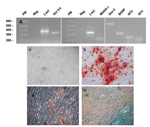 Stromal cells expressed transcription factors and neurotrophins and differentiated in characteristic mesodermal derivatives. RT-PCR from stromal cells was performed as described in the methods section using specific primers for Oct 3/4, Sox-2, Mash-1, BDNF, NT3, and NT4 (table 2). A) Olfactory mucosa stromal cells constitutively express early transcription factors Oct 3/4, Mash-1, and Sox-2 (HBC and GBC) olfactory precursors, as well as growth factors BDNF, NT3, and NT4 (ensheathing cells). Results are representative of at least three independent experiments. (B) Stromal cells differentiated after 14-21 days into mesodermal lineages: a) mesenchymal stromal cells in DMEM/F12-CM; b) calcium deposition in red suggesting osteoblasts; c) adipocytes (white head arrows), and d) Alcian blue deposition in chondrocytes. Micrographs show calcium deposits (red deposits in b), oil red fatty acid inclusions (c), and Alcian blue positive stain (d) in stromal cells. Results are representative of at least three independent experiments.