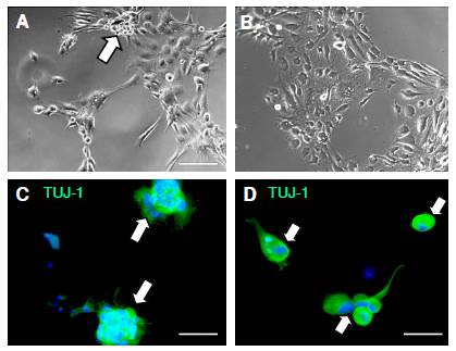 Human olfactory mucosa MSC mesenchymal neurospheres expressed the TUJ-1 protein of immature neurons. Differentiation of mesenchymal neurospheres from MSCs grown in coverslips in DMEM/F12-GF and DMEM/F12-RA + FORSK. MSCs were adapted to the lack of serum and seeded in DMEM/F12-G. Single cells from spheres were cultured in DMEM/F12-GF (A, C) and in DMEM/F12-RA+FORSK (B, D). Cells differentiated as mixed stroma and spheres (A, white arrow) or as predominant stroma (B). TUJ-1 (green) immunolabeling was found in spheres (C) and in single cells (D) from olfactory MSCs grown in coverslips in DMEM/F12-GF and DMEM/F12-RA + FORSK. Counterstaining was done with DAPI. Scale bar: A, B (100 um); C (50 µm); D (25 µm)
