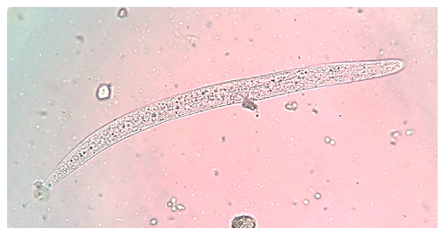 Wet mount of stool showing a Strongyloides stercoralis rhabditiform larva. Rhabditoid esophagus can be appreciated. Methylene blue, 100X.