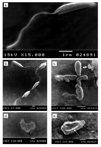 Ultrastructural changes observed in promastigotes from the different media under study. a and b: Normal shape of parasite inoculated in fresh media with no drug added after 48 hours of culture. c: Auranofin-treated parasite showing shape distortion and loss of flagella and some showing a round form (arrow). d: Severe distortion in the shape and loss of flagella with detached membrane in lopinavir/ritonavir-treated promastigote. e: Sorafenib-treated promastigote showing a large dimple (arrow) on its body surface as well as loss of flagella.