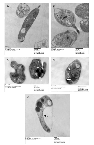 Ultrastructural changes in promastigotes from different media. a and b: Normal parasite inoculated in fresh media with no drug added after 48 hours of culture. c: Auranofin-treated promastigotes showing evident acidocalcinosis (arrows). d: Lopinavir/ritonavir-treated promastigotes showing evident acidocalcinosis (thick arrow) and degenerated nuclear membrane (thin arrow) with condensed chromatin granules close to the nuclear membrane suggesting apoptosis. Vacuoles with different densities and autophagy vesicles with double membrane were also present. e: Sorafenib- treated promastigotes showing acidocalcinosis and shrinkage of the cytoplasm (arrow).