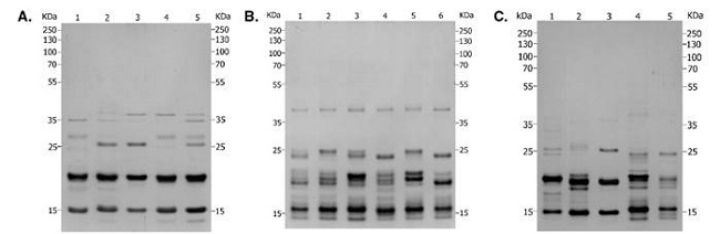 Prote&iacute;nas salivales en geles de SDS-PAGE al 12 %, coloreados con nitrato de plata. A) Especies del g&eacute;nero Rhodnius: (1) R. picitipes, (2) R. pallescens, (3) R. colombiensis (Coyaima, Tolima), (4) R. prolixus (Boyac&aacute;), (5) R. robustus (Putumayo). B) Colonias de R. prolixus: (1) Cundinamarca, (2) Tolima, (3) Boyac&aacute;, (4) Casanare, (5) Magdalena y (6) Santander. C) Colonias de R. colombiensis: (1) Ibagu&eacute;, (2) Icononzo, (3) Coyaima, (4) Chaparral y (5) L&iacute;bano