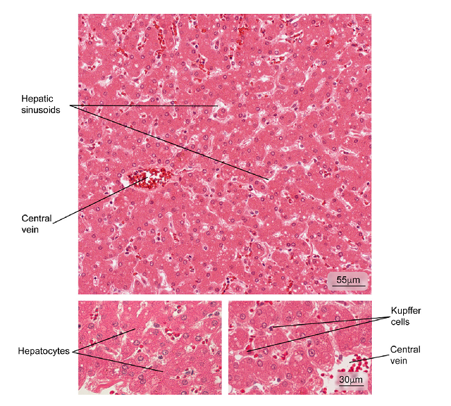 Normal liver tissue. Part of a hepatic lobule is observed; note the radial distribution of the hepatocyte plaques from the central vein. Some phagocytic cells (Kupffer cells) and hepatocytes in greater magnification are observed. Hematoxylin and eosin stain.