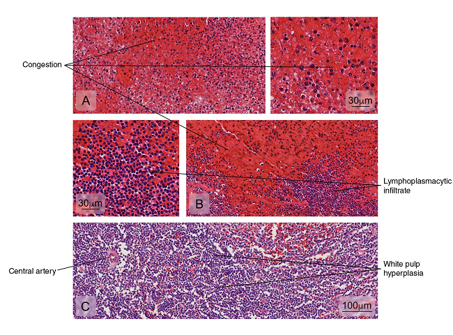 Different kind of splenic tissue alterations are illustrated in: A) Venous sinuses congestion in the red pulp, B) Lymphoplasmacytic cell infiltration in the red pulp, and C) White pulp hyperplasia. Hematoxylin and eosin stain.
